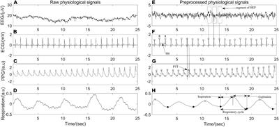 Effects of 24-h acute total sleep deprivation on physiological coupling in healthy young adults